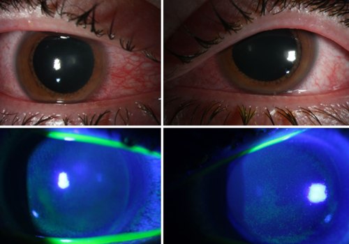 The Truth About UV Light: Safety, Risks, and Benefits