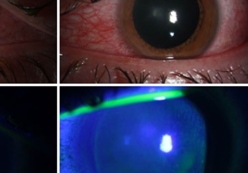 The Dangers of Ultraviolet and Infrared Light Exposure: What You Need to Know
